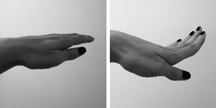 Hyperextended fingers Hyperextended fingers